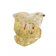 Демонстрационная модель зубов с патологиями IMG